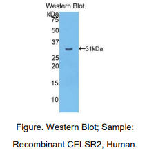 人钙粘蛋白EGF LAG七经G-型受体2(CELSR2)多克隆抗体