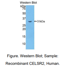 https://msimg.bioon.com/bionline/goods-no-pic.png