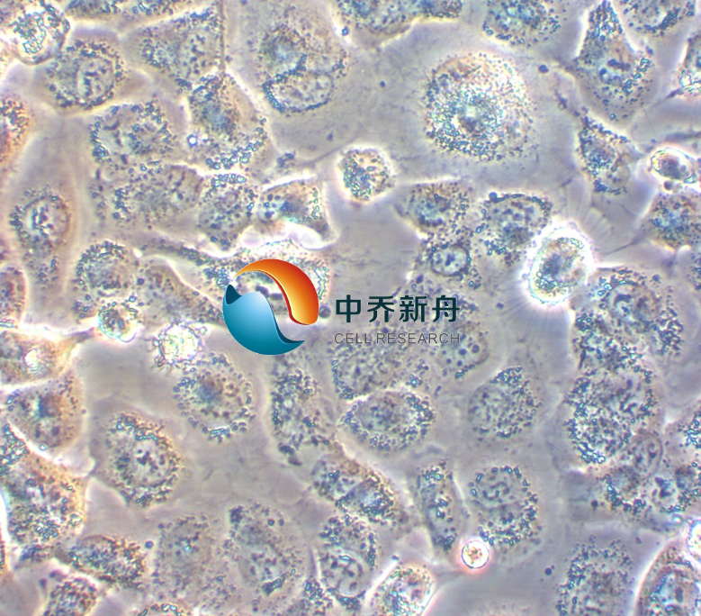 人大细胞肺癌细胞NCI-H661
