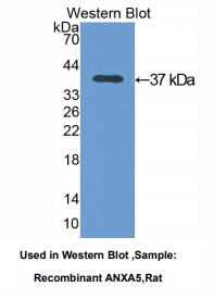大鼠膜联蛋白A5(ANXA5)多克隆抗体