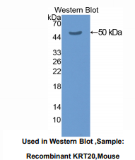 https://msimg.bioon.com/bionline/goods-no-pic.png