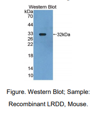 https://msimg.bioon.com/bionline/goods-no-pic.png