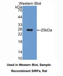 https://msimg.bioon.com/bionline/goods-no-pic.png