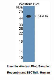 https://msimg.bioon.com/bionline/goods-no-pic.png