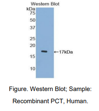人降钙素原(PCT)多克隆抗体