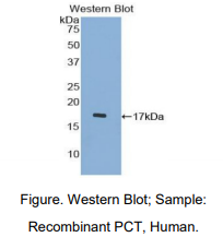 https://msimg.bioon.com/bionline/goods-no-pic.png