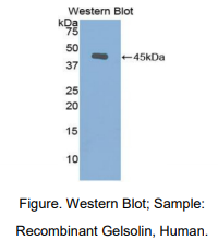 人凝溶胶蛋白(GSN)多克隆抗体