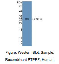 https://msimg.bioon.com/bionline/goods-no-pic.png