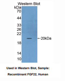 https://msimg.bioon.com/bionline/goods-no-pic.png