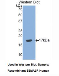 https://msimg.bioon.com/bionline/goods-no-pic.png