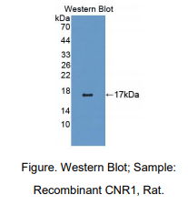 https://msimg.bioon.com/bionline/goods-no-pic.png