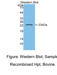 https://msimg.bioon.com/bionline/goods-no-pic.png