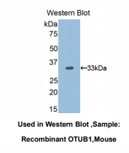 https://msimg.bioon.com/bionline/goods-no-pic.png