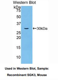 小鼠血清/糖皮质激素调节激酶3(SGK3)多克隆抗体
