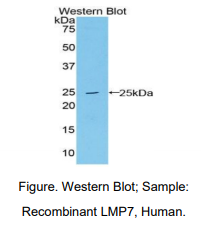 https://msimg.bioon.com/bionline/goods-no-pic.png