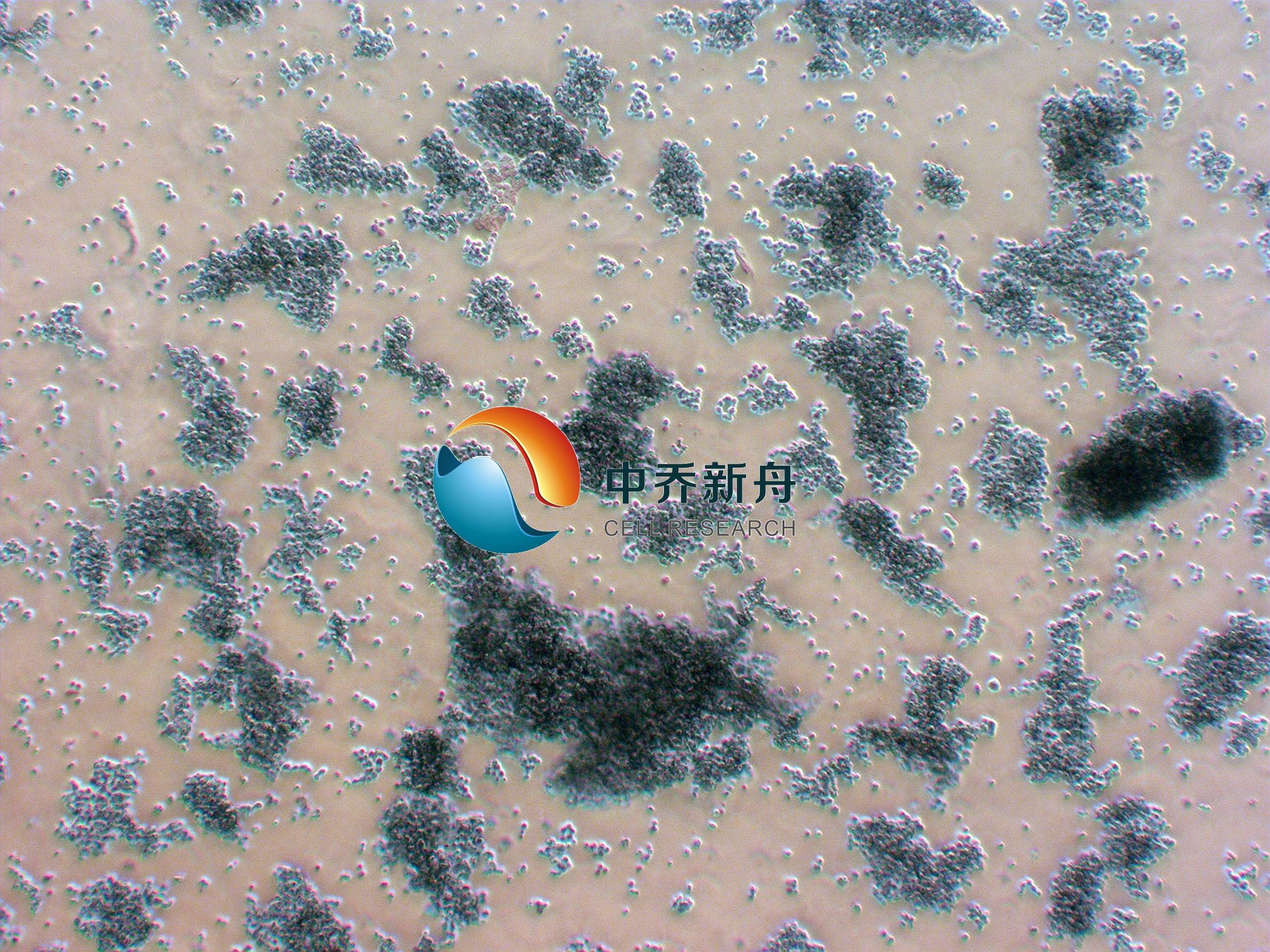 Y79-GFP+LUC人视网膜母细胞瘤细胞-绿色+荧光素酶标记