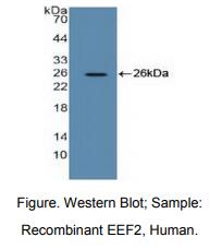 人真核翻译延伸因子2(EEF2)多克隆抗体