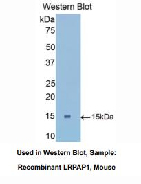 https://msimg.bioon.com/bionline/goods-no-pic.png