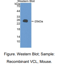 小鼠纽蛋白(VCL)多克隆抗体