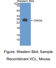 https://msimg.bioon.com/bionline/goods-no-pic.png