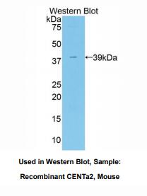 https://msimg.bioon.com/bionline/goods-no-pic.png