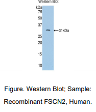 https://msimg.bioon.com/bionline/goods-no-pic.png