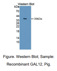 https://msimg.bioon.com/bionline/goods-no-pic.png