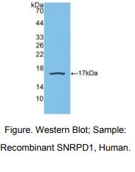 人小核糖核蛋白多肽D1(SNRPD1)多克隆抗体