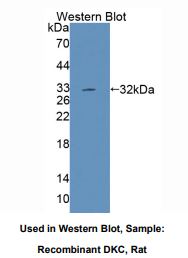大鼠角化不良蛋白(DKC)多克隆抗体