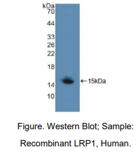 https://msimg.bioon.com/bionline/goods-no-pic.png