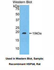 大鼠热休克蛋白β6(HSPb6)多克隆抗体