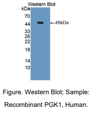 https://msimg.bioon.com/bionline/goods-no-pic.png