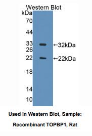 https://msimg.bioon.com/bionline/goods-no-pic.png