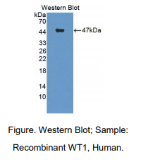 人肾母细胞瘤蛋白1(WT1)多克隆抗体