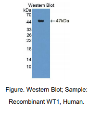 https://msimg.bioon.com/bionline/goods-no-pic.png