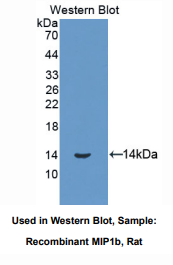 https://msimg.bioon.com/bionline/goods-no-pic.png