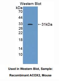 https://msimg.bioon.com/bionline/goods-no-pic.png