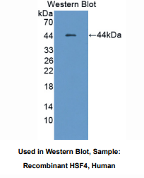 https://msimg.bioon.com/bionline/goods-no-pic.png