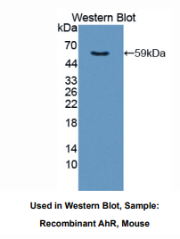 https://msimg.bioon.com/bionline/goods-no-pic.png