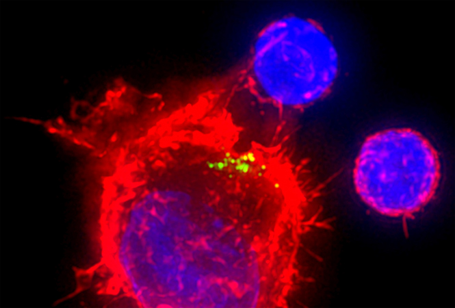 Front Immunol：强直性脊柱炎患者外周血单个核细胞的整合单细胞RNA-<font color="red">SEQ</font>和ATAC-<font color="red">SEQ</font>分析