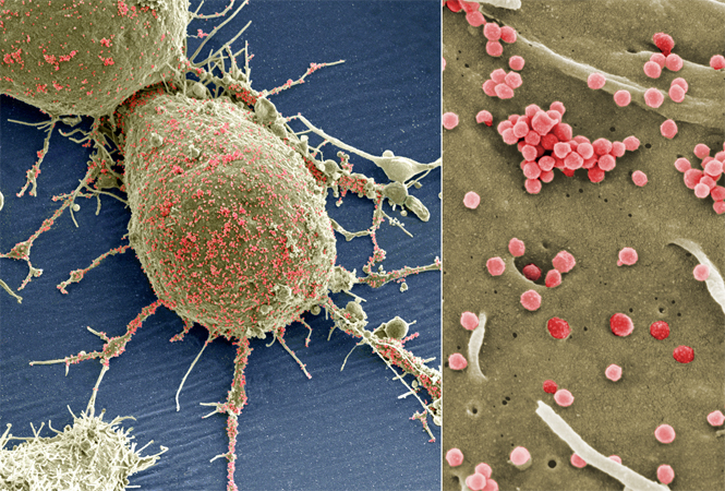 Nat Med：<font color="red">Belzutifan</font>抑制肾细胞癌的I期试验和生物标志物分析