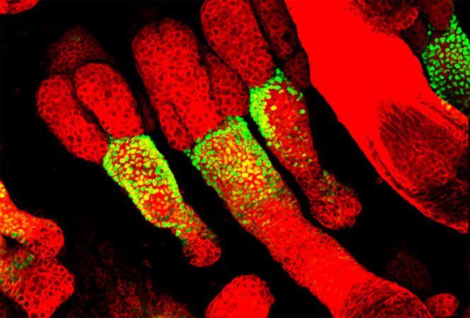 Front Immunol：非<font color="red">伤寒</font>沙门氏菌病史与系统性红斑狼疮风险的相关性研究
