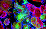 Cell Death Dis：MYC调控假基因<font color="red">HMGA</font><font color="red">1</font>P6转录促进卵巢癌发生发展