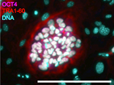 Int J Mol Sci：<font color="red">骨骼</font><font color="red">微</font><font color="red">环境</font>中TGF-β信号对癌细胞和癌干细胞的影响