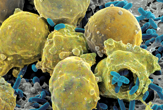 双特异性抗体之T细胞结合器，改变肿瘤免疫治疗！