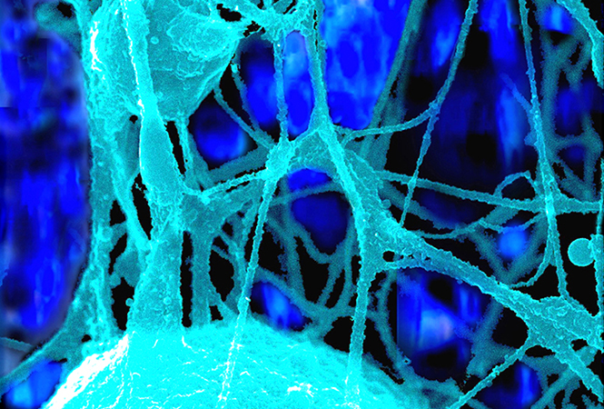 Nature：星形胶质细胞诱导的中枢神经系统炎症与肠道微生物有关！