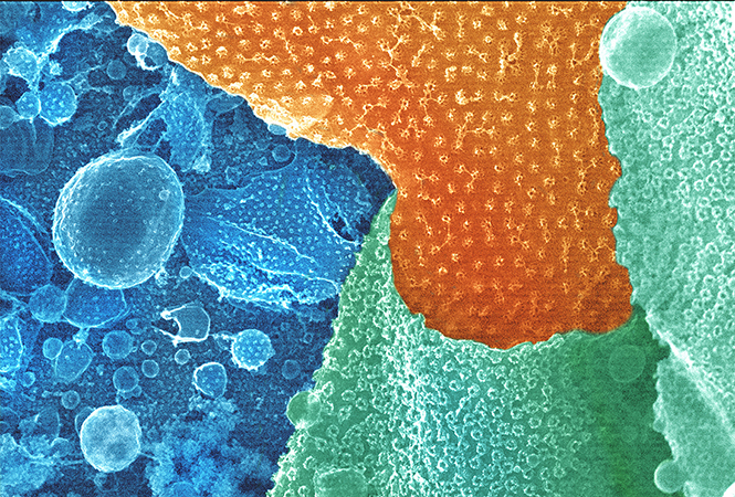 Cell Discovery：通过临床试验证实，金银花可抑制新冠病毒复制，加速患者好转