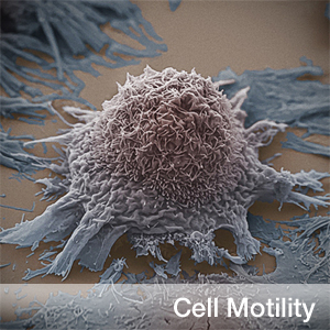 Molecular Cell：发现引起T细胞耗竭的关键<font color="red">复合物</font>，有望提高T细胞疗法持久抗癌能力！