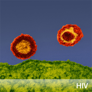 科学家利用CRISPR技术成功清除已感染的HIV病毒