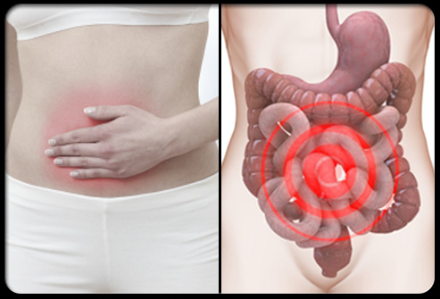 Gastroenterology：结直肠腺瘤风险分类系统的比较
